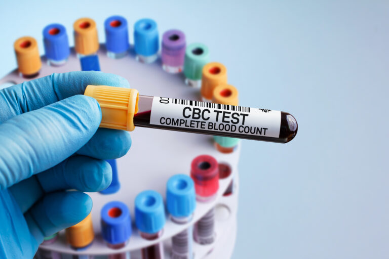 Blood Test Image